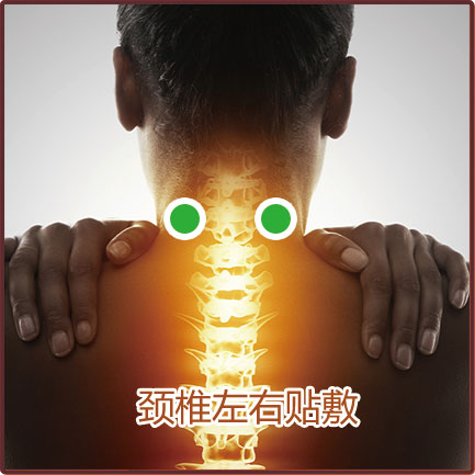 動(dòng)脈型頸椎病貼敷位置示意圖